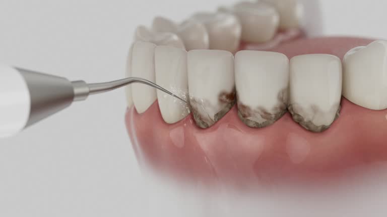 Reliable Dental contractor in Helena, MT by Smile Center Dentistry